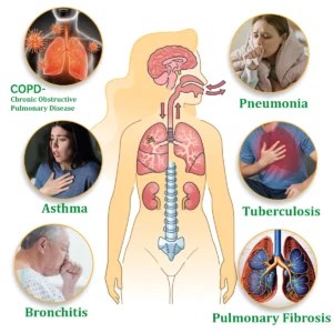 Official Store:Ourlyard™ Herbal Lung Cleansing Inhaler