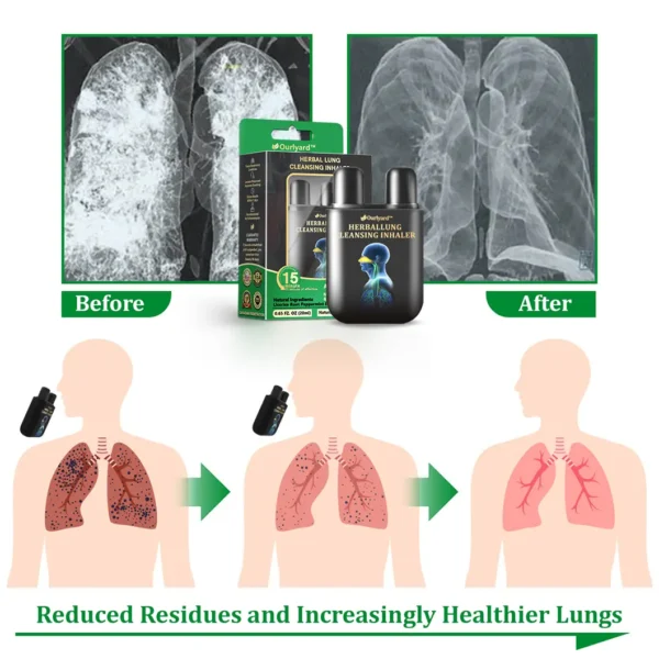 Official Store:Ourlyard™ Herbal Lung Cleansing Inhaler