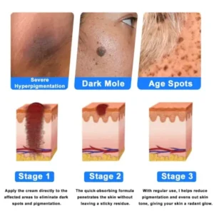 Ourlyard® Skin Treatment Cream