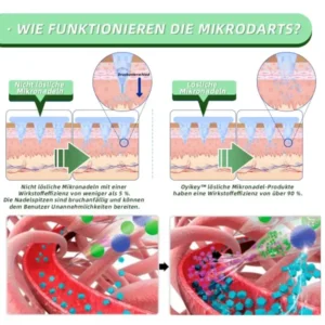 Ourlyard™SMGT-GLP-1 Nano-Mikronadel-Pflaster